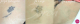 Laserowe usuwanie tatuazu